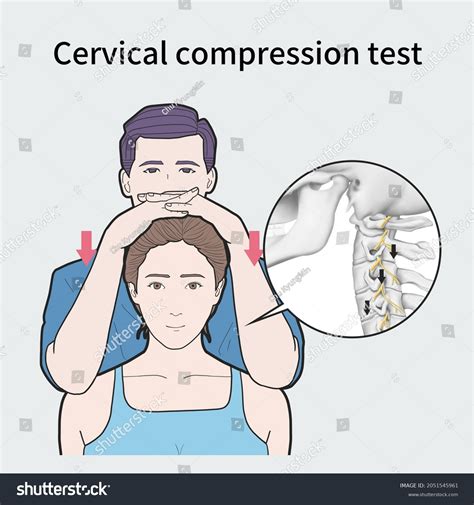 jackons cervical compression test|cervical orthopedic tests pdf.